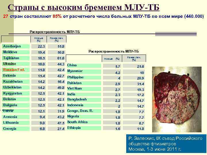  Страны с высоким бременем МЛУ-ТБ 27 стран составляют 85% от расчетного числа