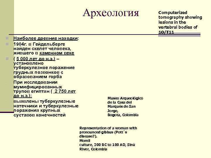        Археология     Computerized 