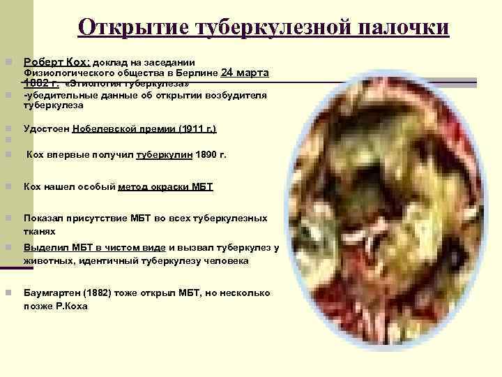    Открытие туберкулезной палочки n  Роберт Кох: доклад на заседании Физиологического