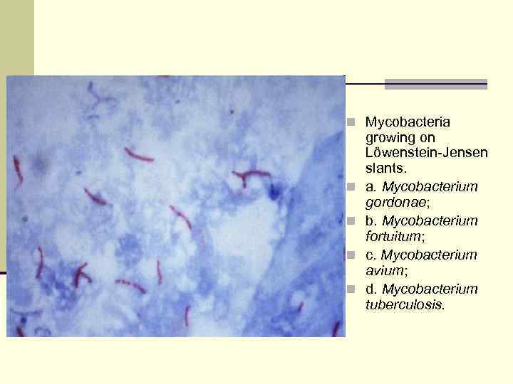 n Mycobacteria growing on Löwenstein-Jensen slants. n  a. Mycobacterium gordonae; n  b.