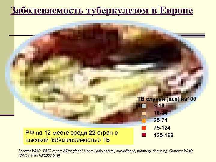 Заболеваемость туберкулезом в Европе       TB случаи (все) на