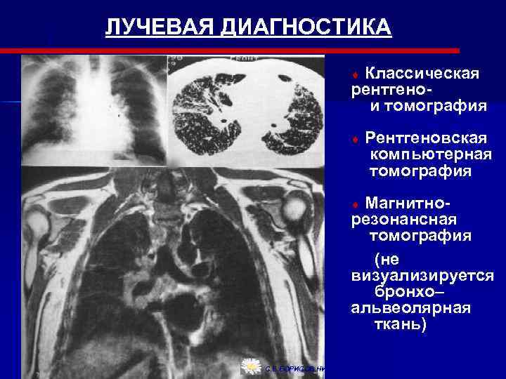 Лучевая диагностика это. Компьютерная томография лекция. Компьютерная томография лучевая диагностика. Рентгеновская компьютерная томография лучевая диагностика. Семиотика лучевой диагностике это.