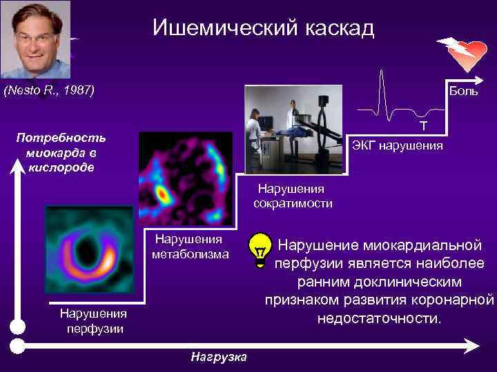 Что такое смад в кардиологии фото