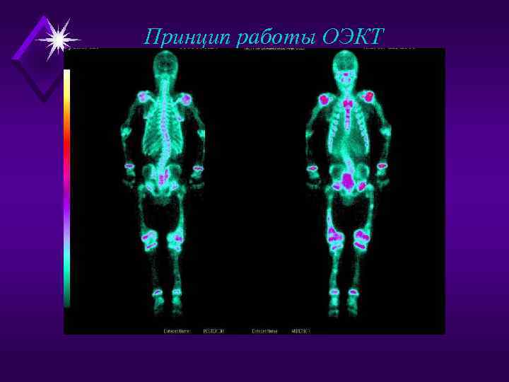 Принцип работы ОЭКТ 
