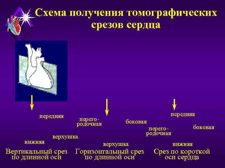   Схема получения томографических    срезов сердца   передняя 