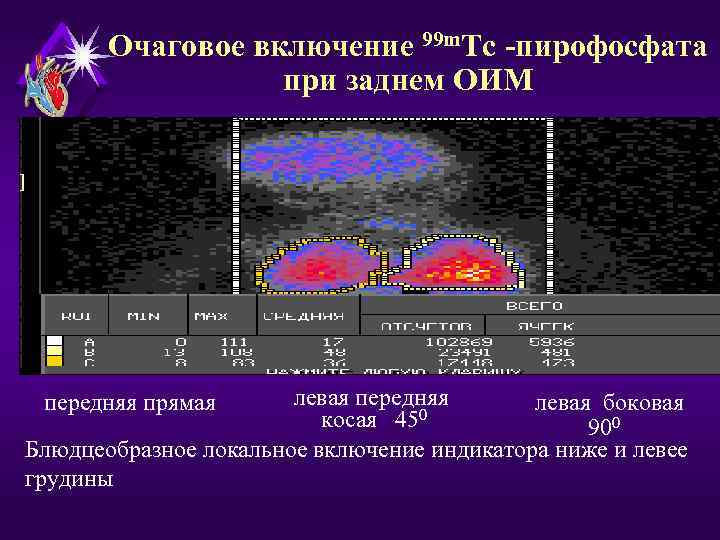 Диагностика вида вольво