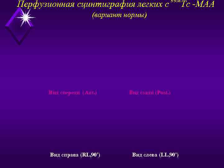      99 м Перфузионная сцинтиграфия легких с   