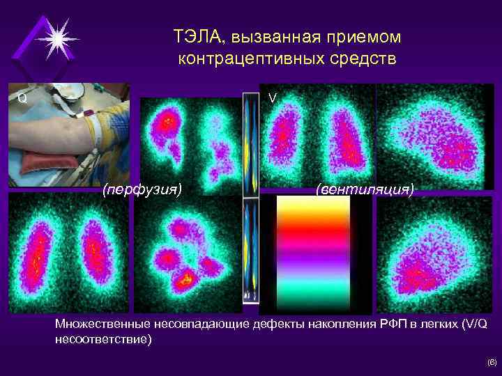 Диагностическая колодка соболь