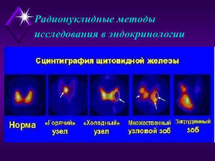 Лучевая диагностика в эндокринологии презентация