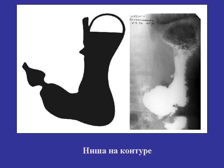 Ниша на контуре Ниша на контуре