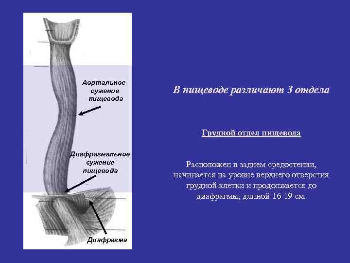 Аортальное сужение В пищеводе различают 3 отдела пищевода Аортальное сужение В пищеводе различают 3 отдела пищевода