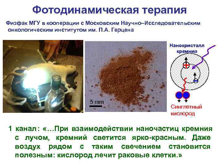   Фотодинамическая терапия Физфак МГУ в кооперации с Московским Научно–Исследовательским онкологическим институтом им.