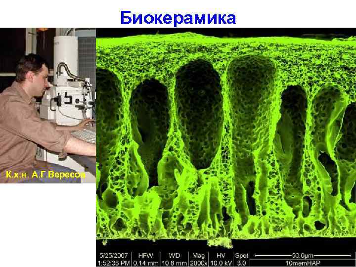      Биокерамика К. х. н. А. Г. Вересов  