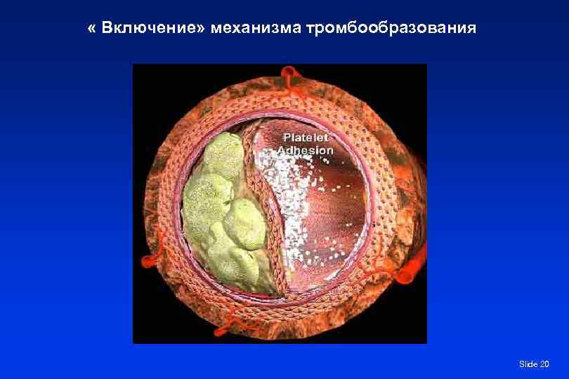  « Включение» механизма тромбообразования    Slide 20 