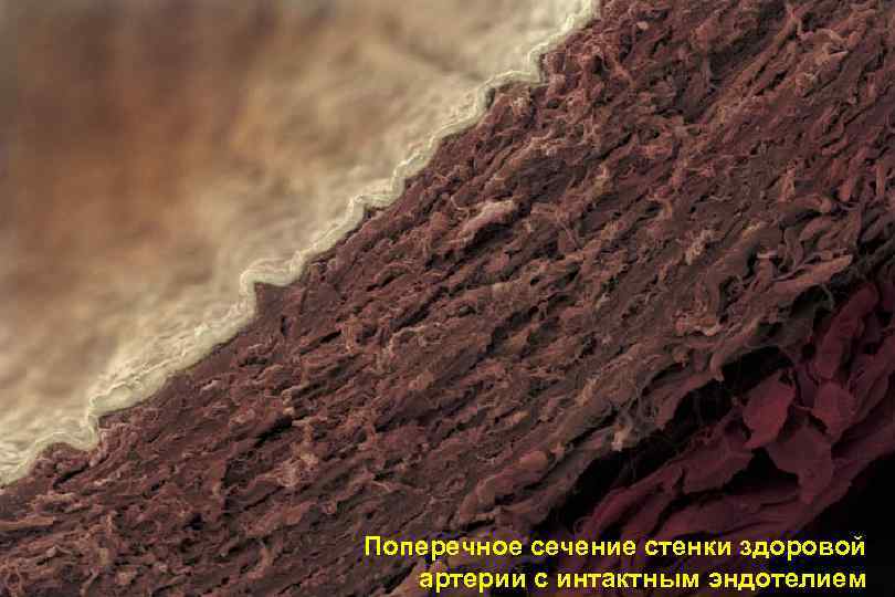 Поперечное сечение стенки здоровой  артерии с интактным эндотелием     