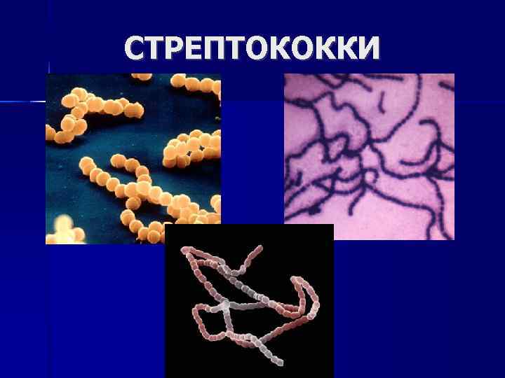 СТРЕПТОКОККИ 