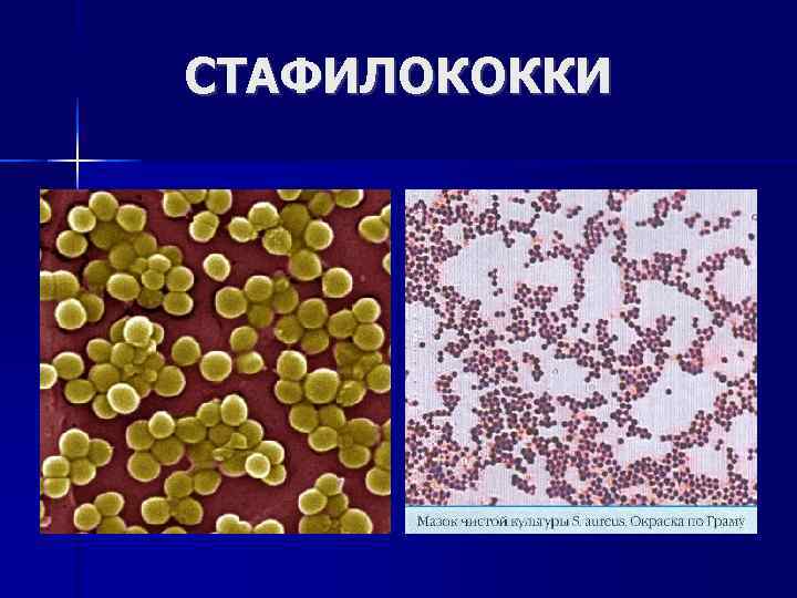 СТАФИЛОКОККИ 