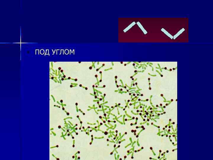  • ПОД УГЛОМ 