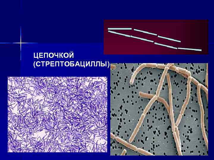 ЦЕПОЧКОЙ (СТРЕПТОБАЦИЛЛЫ) 