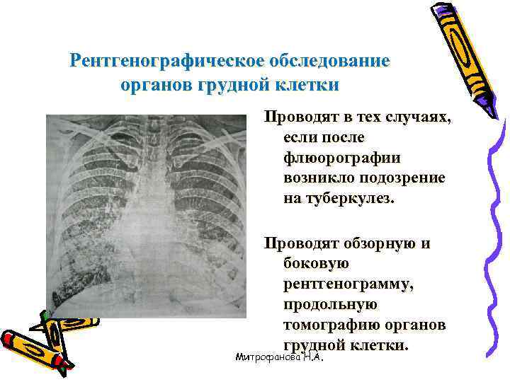 Рентгенографическое обследование органов грудной клетки     Проводят в тех случаях, 