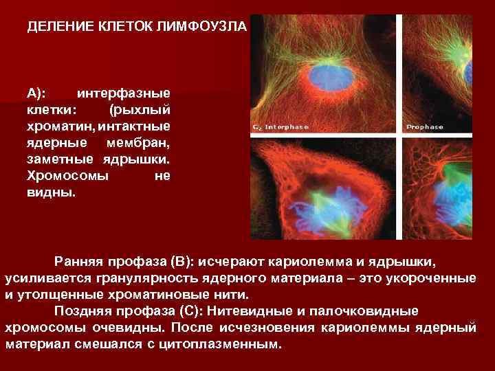 ДЕЛЕНИЕ КЛЕТОК ЛИМФОУЗЛА A): интерфазные клетки: (рыхлый хроматин, интактные ядерные мембран, заметные ядрышки. Хромосомы