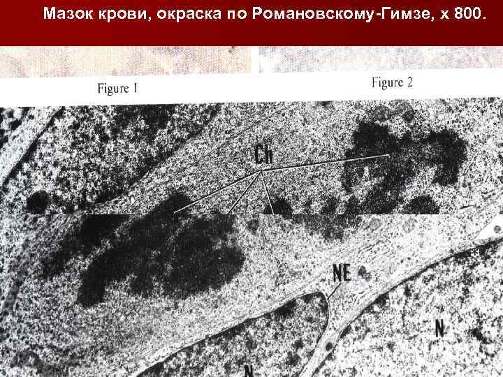 Мазок крови, окраска по Романовскому-Гимзе, x 800. 