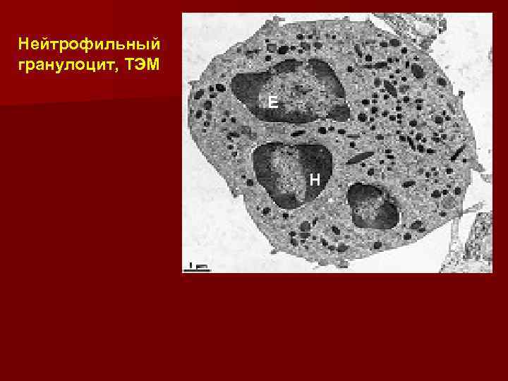 Нейтрофильный гранулоцит, ТЭМ E H 