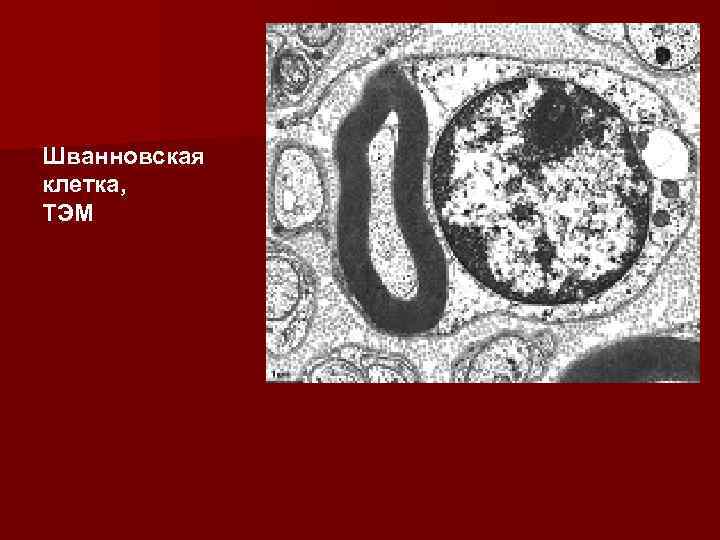 Шванновская клетка, ТЭМ 