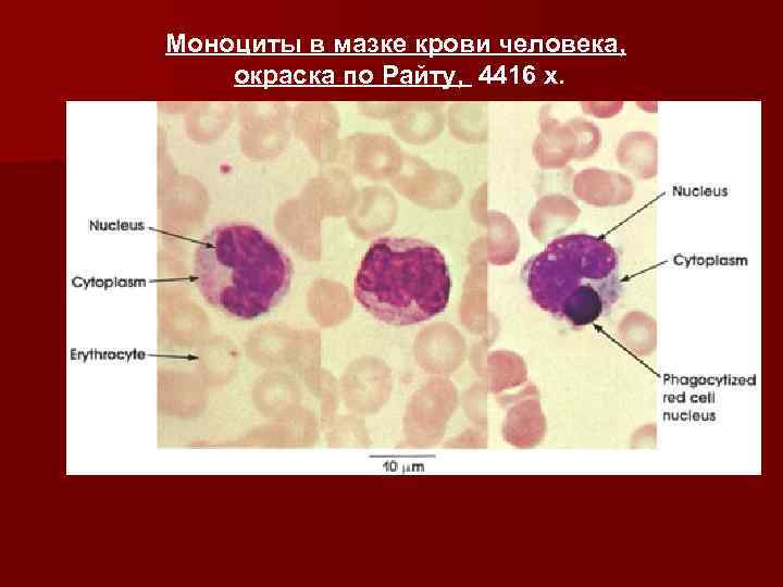 Моноциты в мазке крови человека, окраска по Райту, 4416 x. 