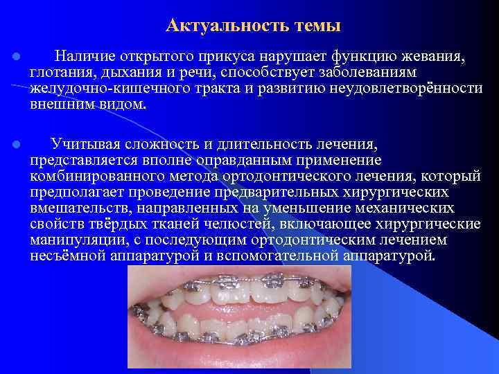 Актуальность темы l Наличие открытого прикуса нарушает функцию жевания, глотания, дыхания и речи, способствует