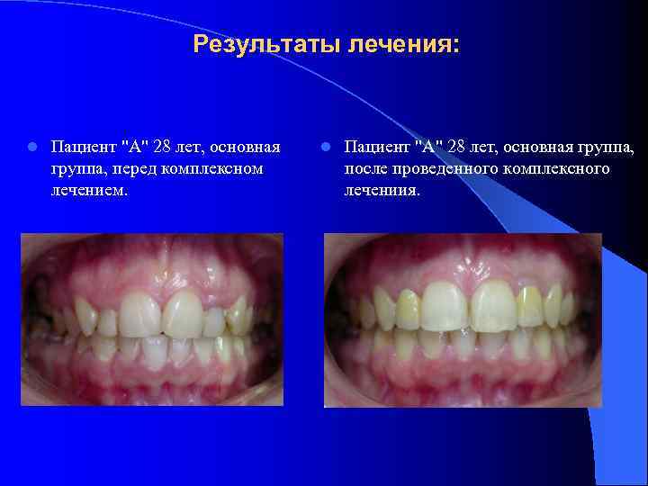 Результаты лечения: l Пациент 