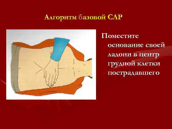 Алгоритм базовой СЛР Поместите основание своей ладони в центр грудной клетки пострадавшего 