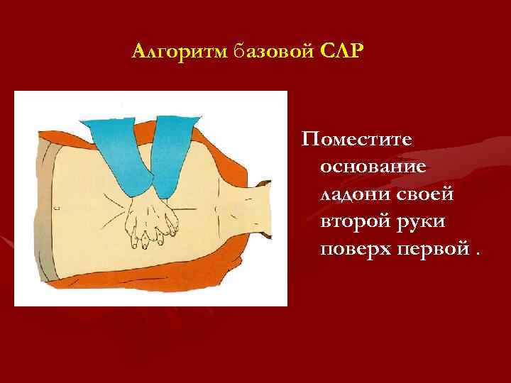Алгоритм базовой СЛР Поместите основание ладони своей второй руки поверх первой. 