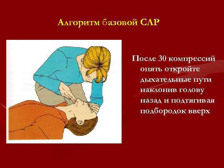 Алгоритм базовой СЛР После 30 компрессий опять откройте дыхательные пути наклонив голову назад и