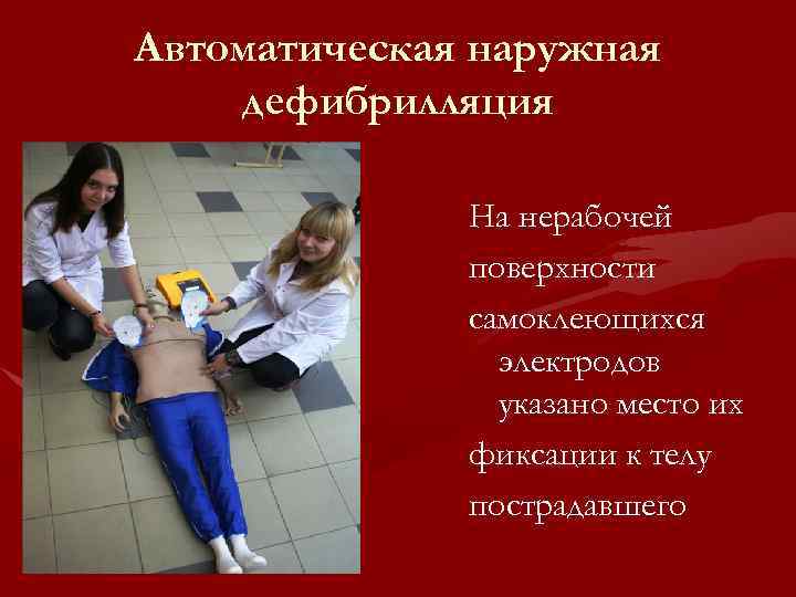 Автоматическая наружная дефибрилляция На нерабочей поверхности самоклеющихся электродов указано место их фиксации к телу