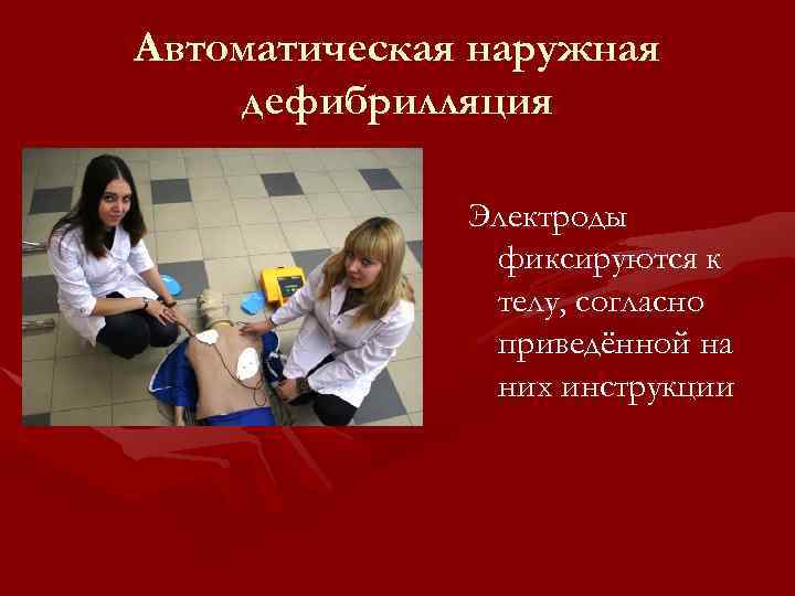 Автоматическая наружная дефибрилляция Электроды фиксируются к телу, согласно приведённой на них инструкции 
