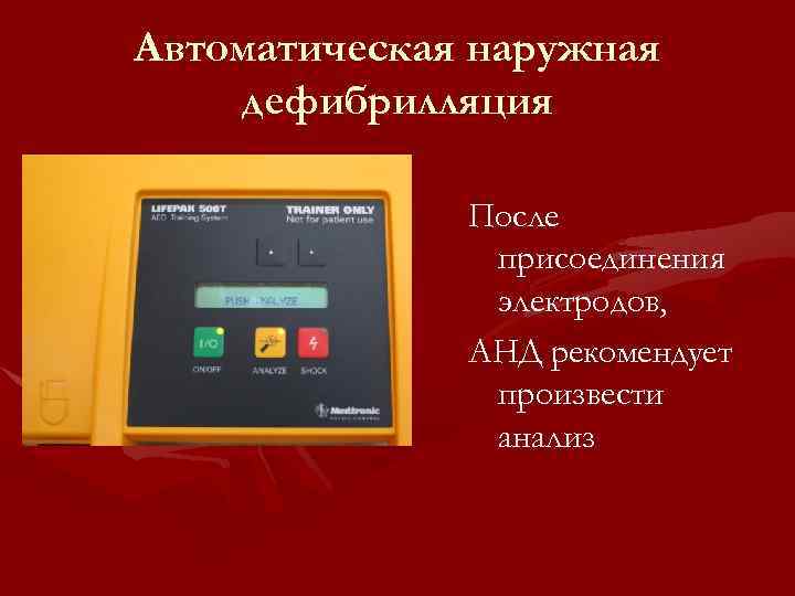 Автоматическая наружная дефибрилляция После присоединения электродов, АНД рекомендует произвести анализ 