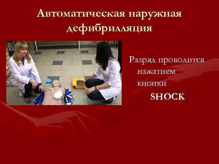 Автоматическая наружная дефибрилляция Разряд проводится нажатием кнопки SHOCK 