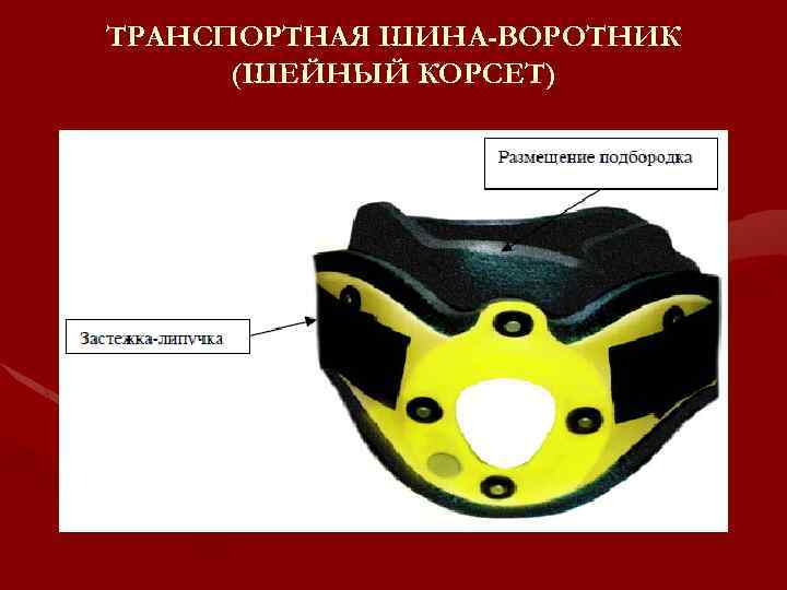 ТРАНСПОРТНАЯ ШИНА-ВОРОТНИК (ШЕЙНЫЙ КОРСЕТ) 