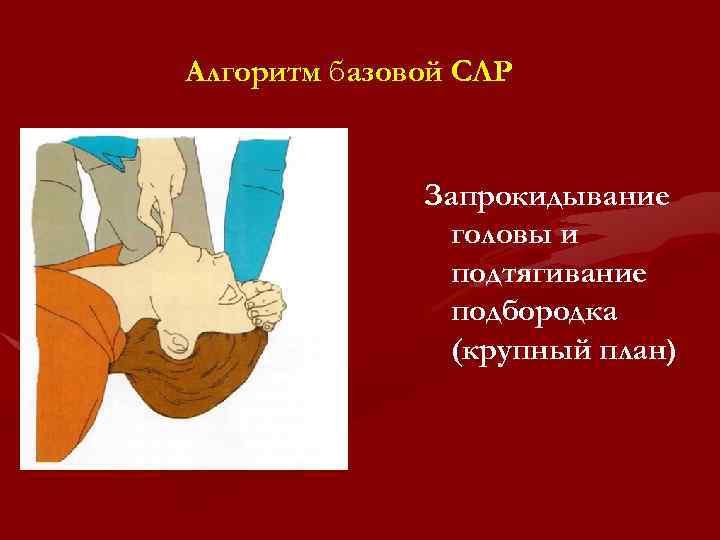 Алгоритм базовой СЛР Запрокидывание головы и подтягивание подбородка (крупный план) 