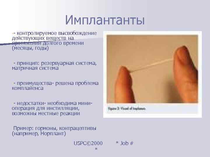     Имплантанты • - контролируемое высвобождение действующих веществ на протяжении долгого