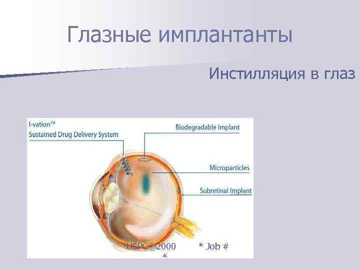 Глазные имплантанты     • Инстилляция в глаз   USPC© 2000
