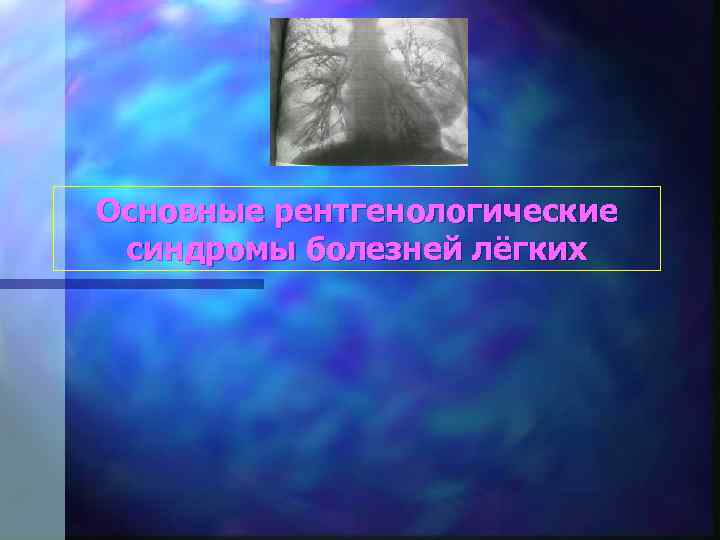 Основные рентгенологические синдромы болезней лёгких 