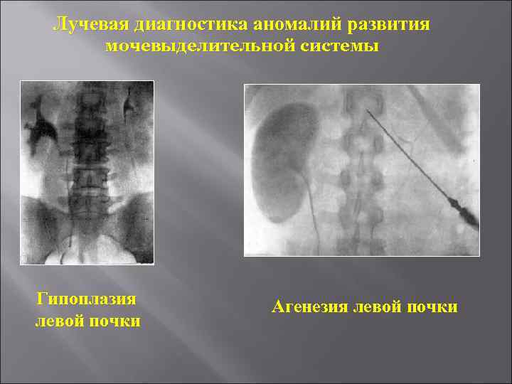 Лучевая диагностика почек презентация