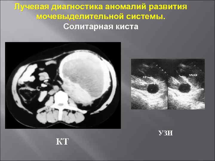 Лучевая диагностика мочевыделительной системы презентация