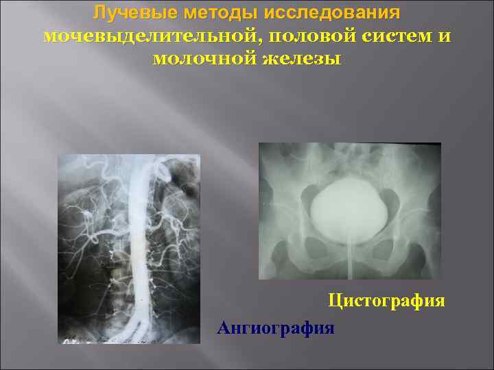   Лучевые методы исследования мочевыделительной, половой систем и   молочной железы 