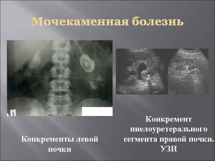 Негативное и позитивное изображение в рентгенологии