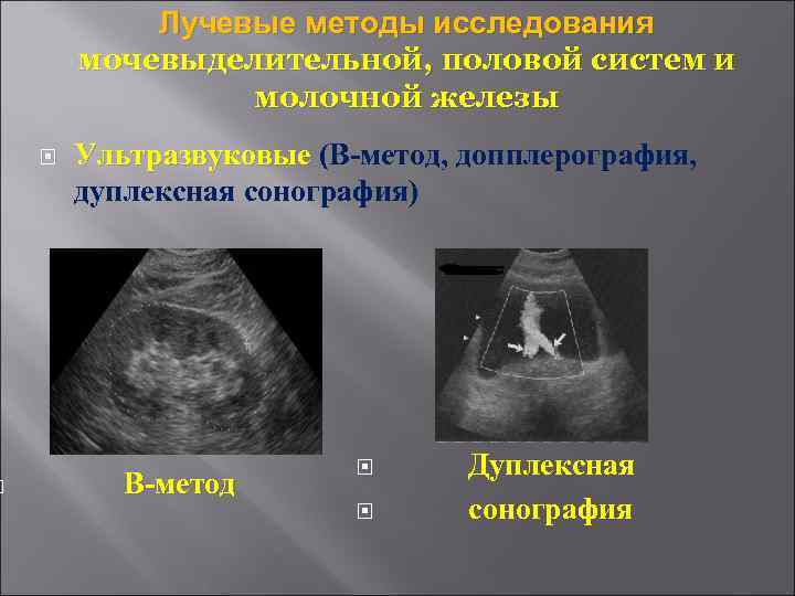   Лучевые методы исследования   мочевыделительной, половой систем и   молочной