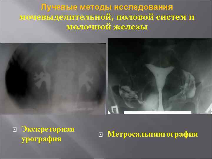 Лучевая диагностика молочных желез презентация