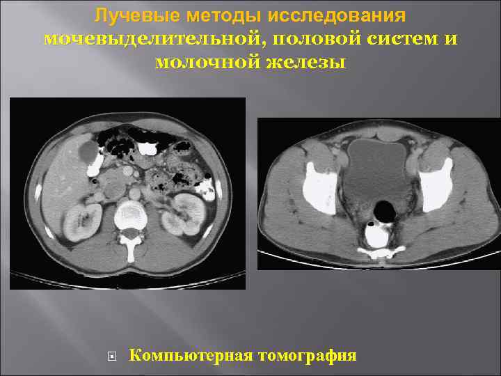   Лучевые методы исследования мочевыделительной, половой систем и   молочной железы 